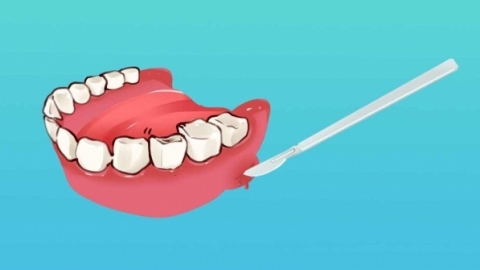 种植牙有使用年限吗 需要注意什么