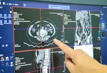 医学影像技术和医学影像学的区别 医学影像技术定义