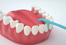 什么是牙线 牙线是什么