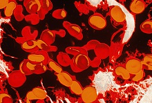 调节红细胞生成的主要体液因素是