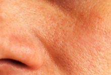 护肤品可以收缩毛孔吗 有哪些收缩毛孔的护肤方式